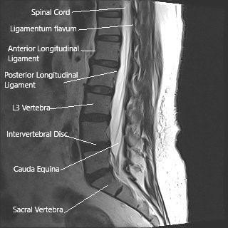 Cauda Equina Syndrome - Complete Orthopedics | Multiple NY Locations