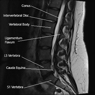 Hip Pain and Sciatica - Complete Orthopedics | Multiple NY Locations