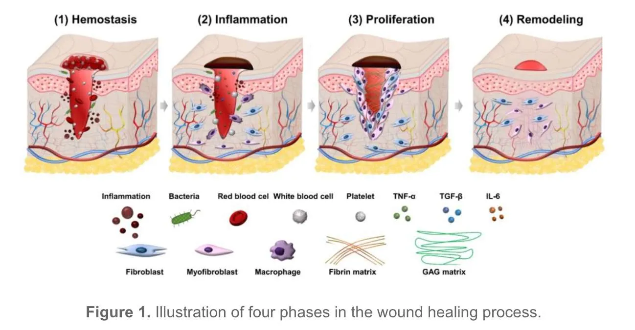 4 Stages of Healing a Wound with Pictures | Credihealth