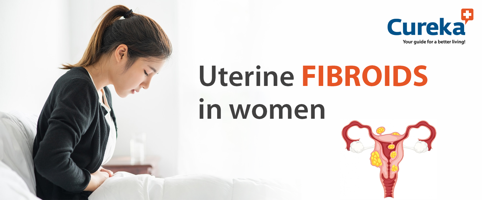 Uterine Fibroids in Women - Cureka