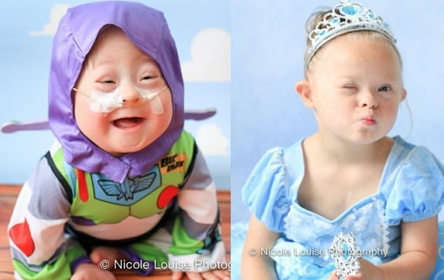 Bikin Haru, 10 Potret Anak Penderita Down Syndrom Pakai Kostum Disney Favorit