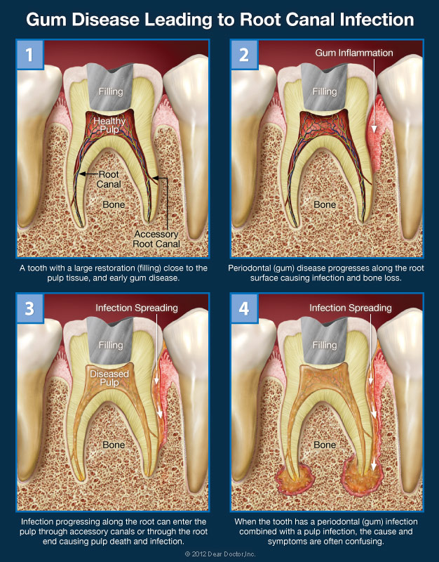 Sinus Tooth Pain One Side Sales USA, Save 68% | jlcatj.gob.mx