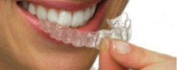 L'orthodontie par syst?me de goutti?re