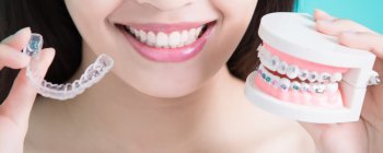 braces vs invisalign uk