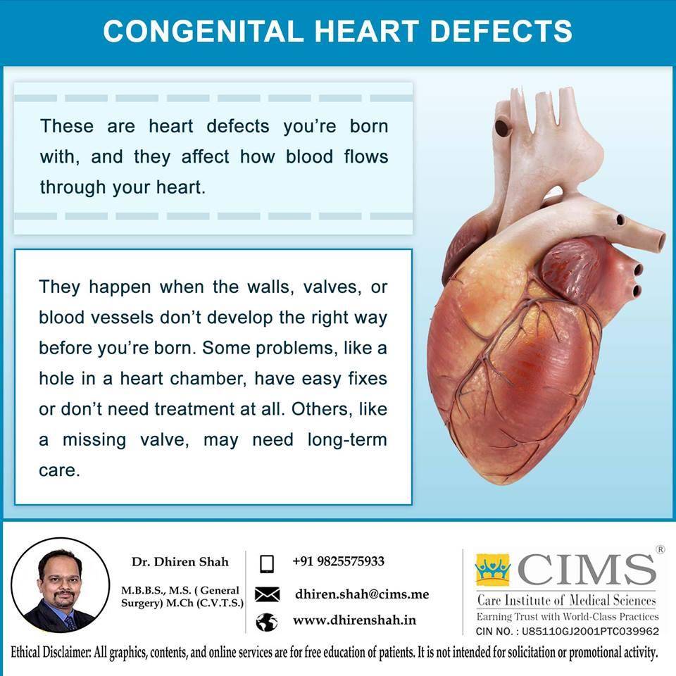 Congenital Heart Defects Types