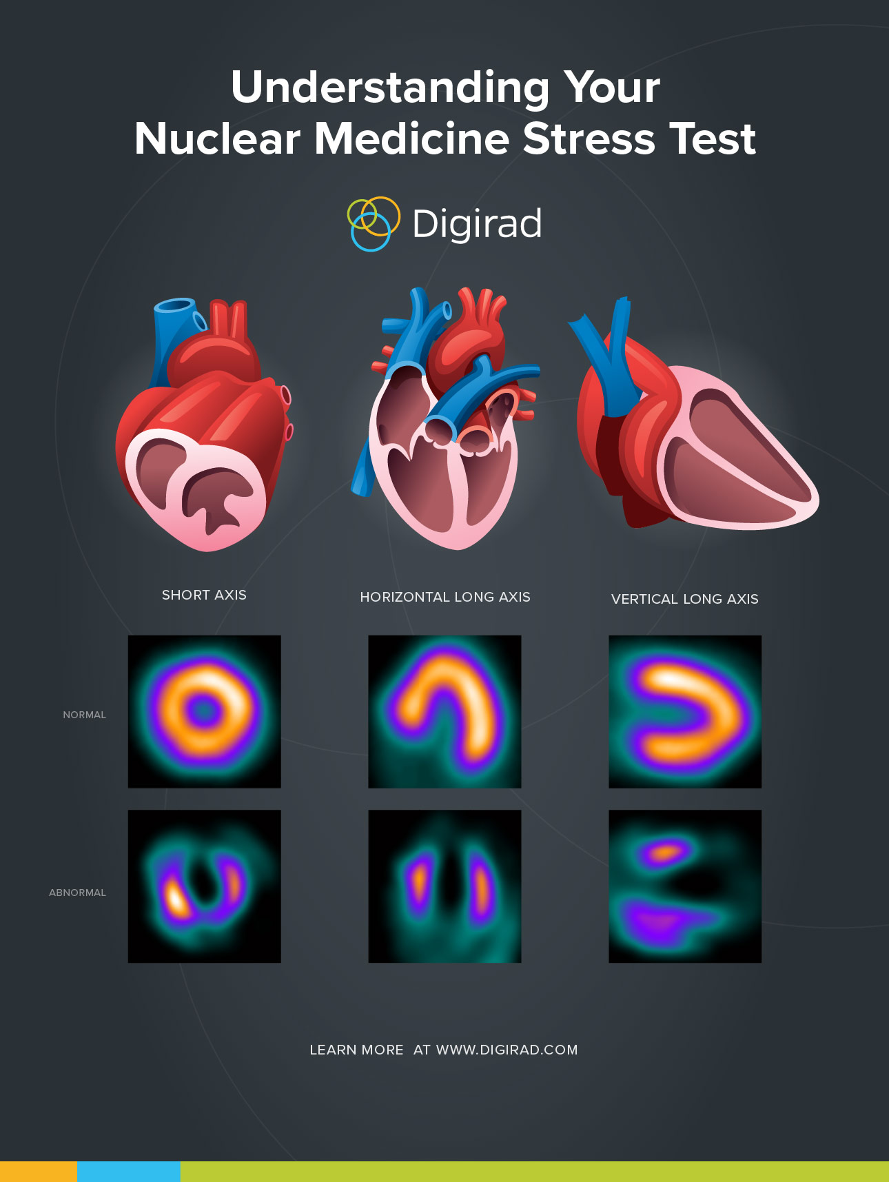 Understanding Your Nuclear Medicine Stress Test