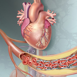 Medical Illustration & Animation