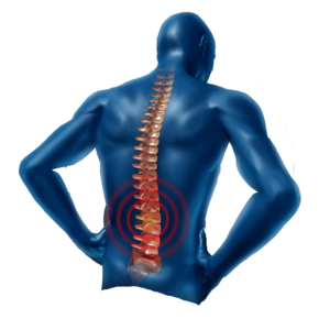 Back Pain Transparent PNG PNG Clip art