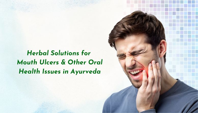 Herbal Solutions for Mouth Ulcers and Other Oral Health Issues in Ayurveda