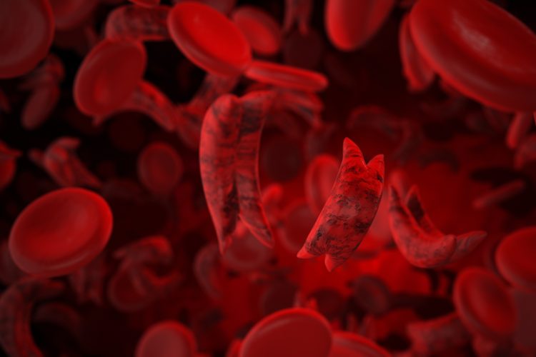 Sickle cell disease medical concept 3D Illustration