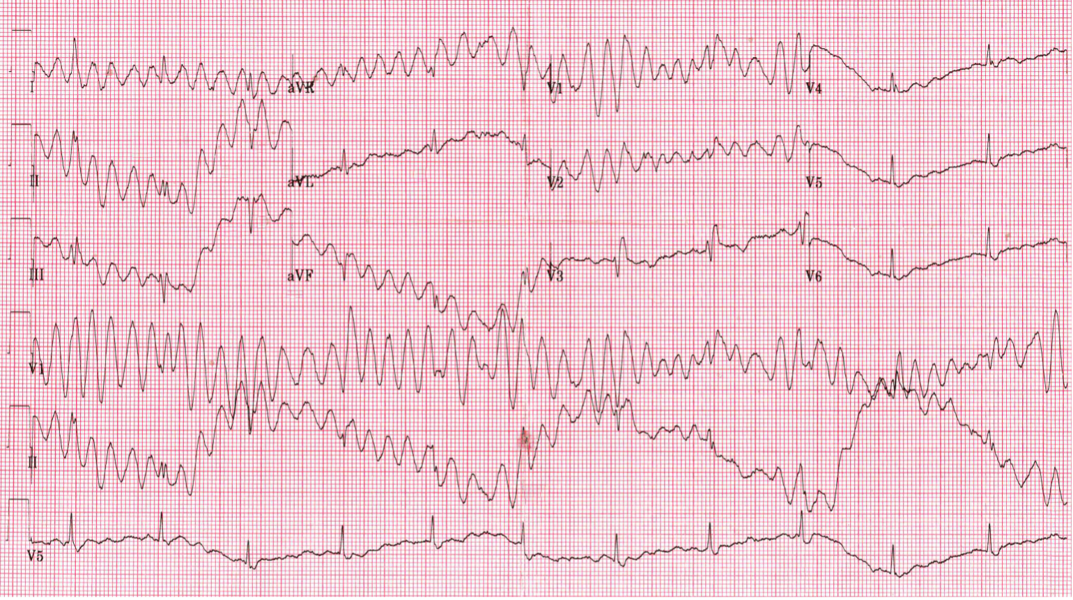 ECG Challenge Figure.png