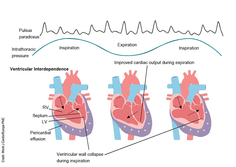 CCUS - MV Velocity - Fig 2.jpg