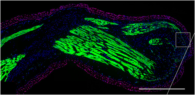 Salamander limb