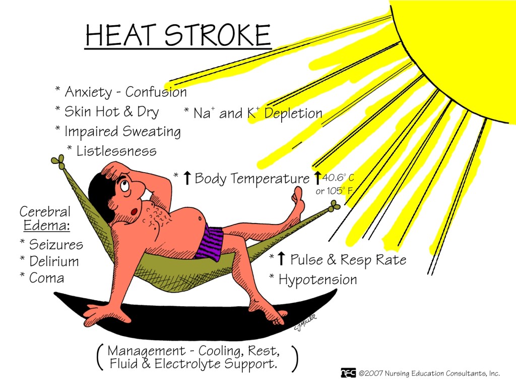 First Aid For Heart Stroke