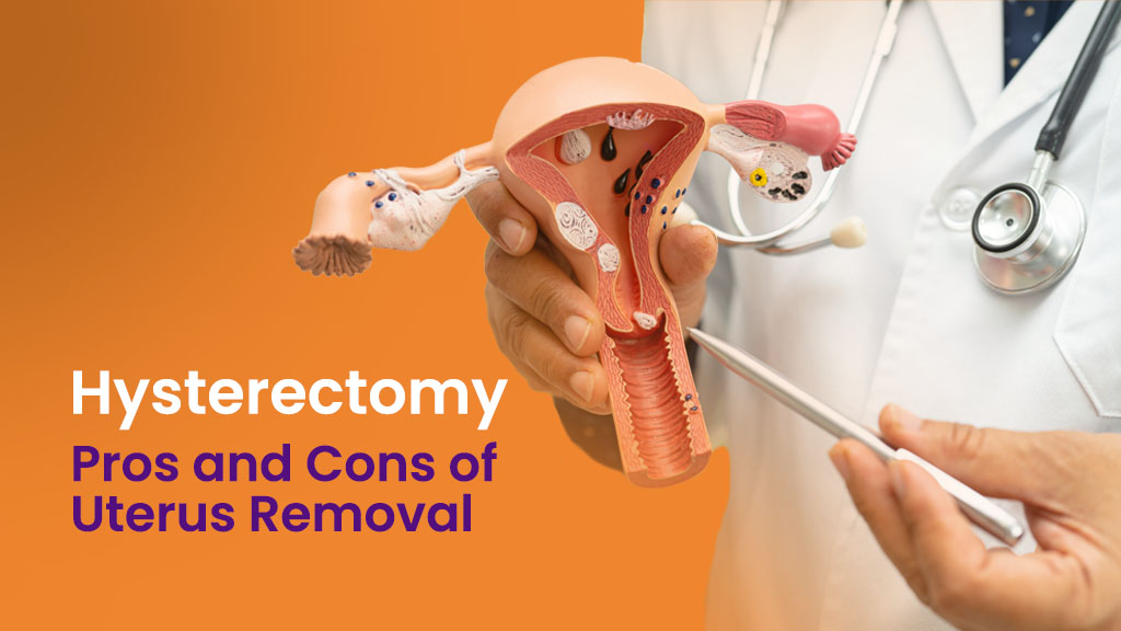 Hysterectomy: Pros and Cons of Uterus Removal