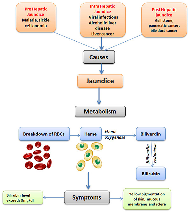 Jaundice: Pathology Review: Video, Anatomy Definition, 42% OFF