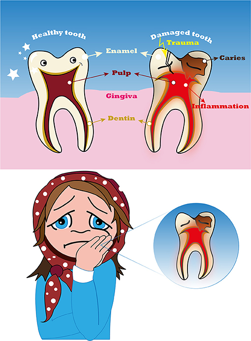 Tooth Pain After Injury