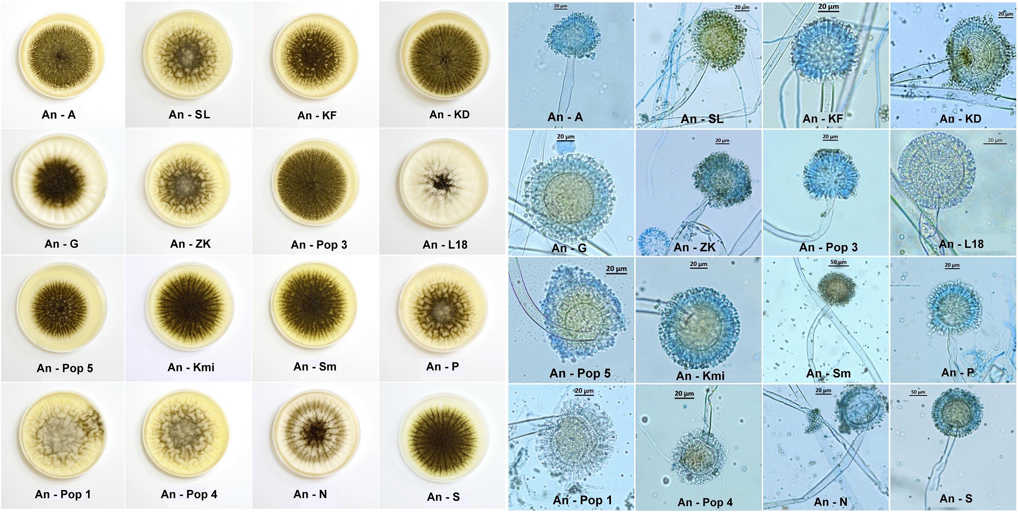 Aspergillus Niger Characteristics Life Cycle And Dise - vrogue.co