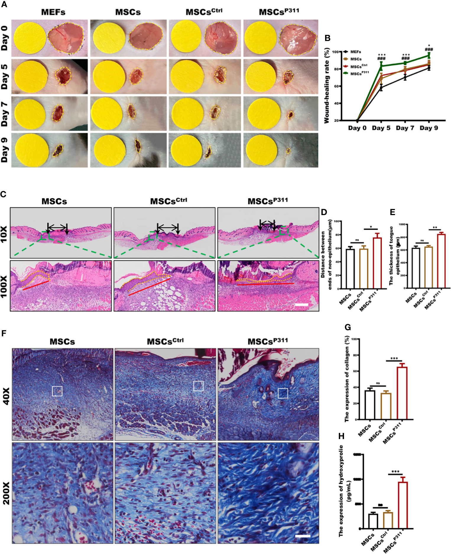 Frontiers | P311 Facilitates the Angiogenesis and Wound Healing ...