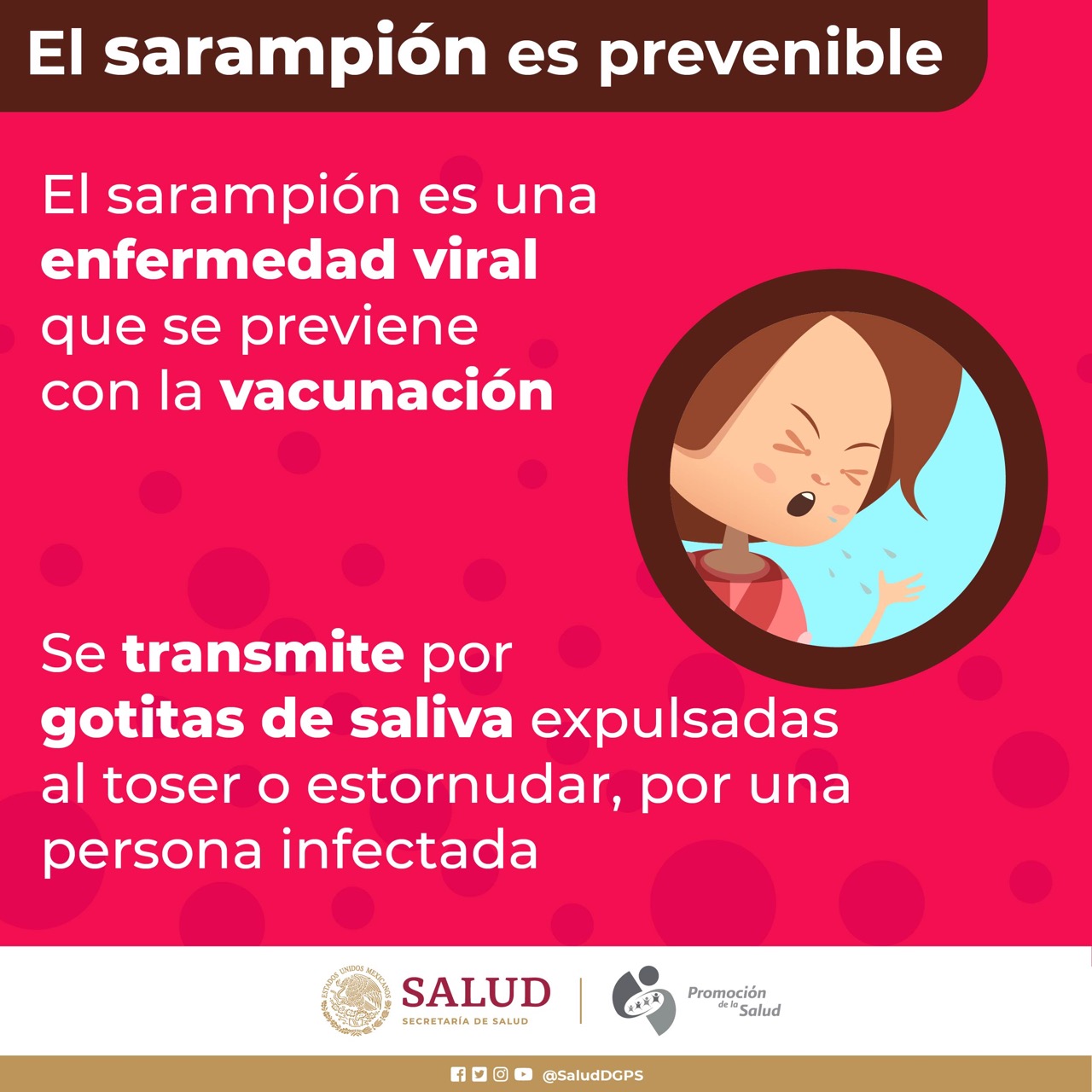 El sarampión es prevenible 