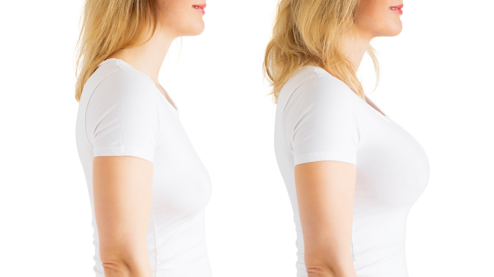 Woman evaluating breast implants