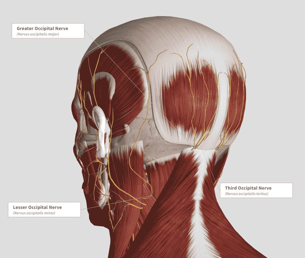 Occipital Neuralgia Cures