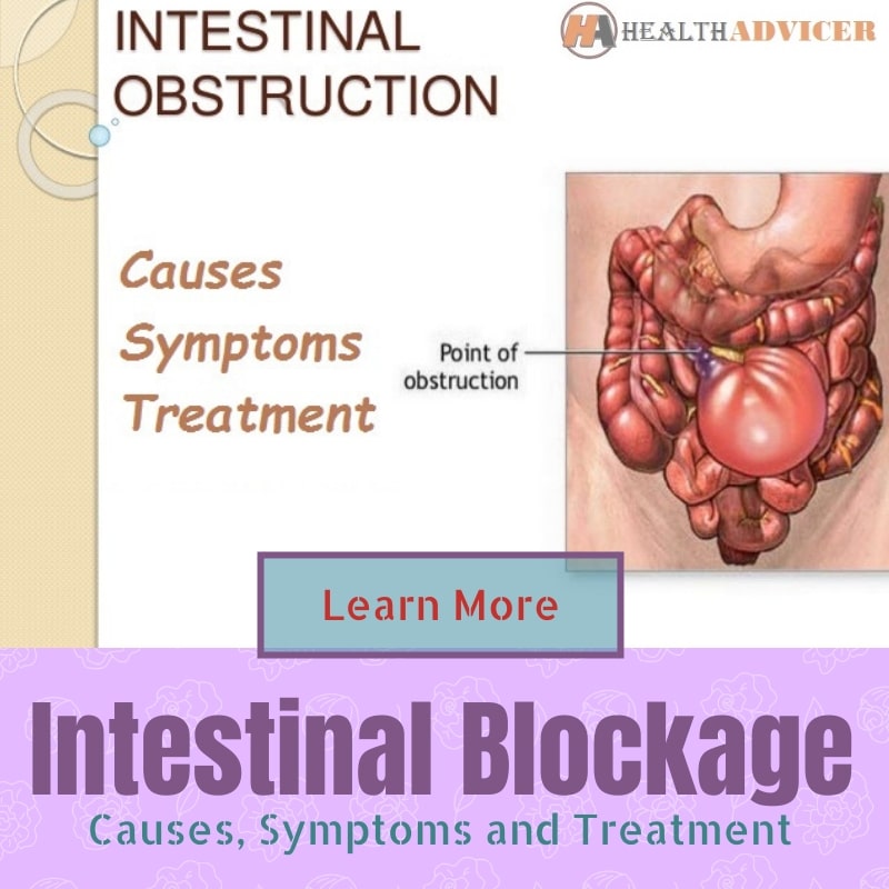 Intestinal Blockage