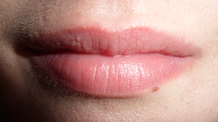 Small White Bumps on Lips – Causes and Treatment