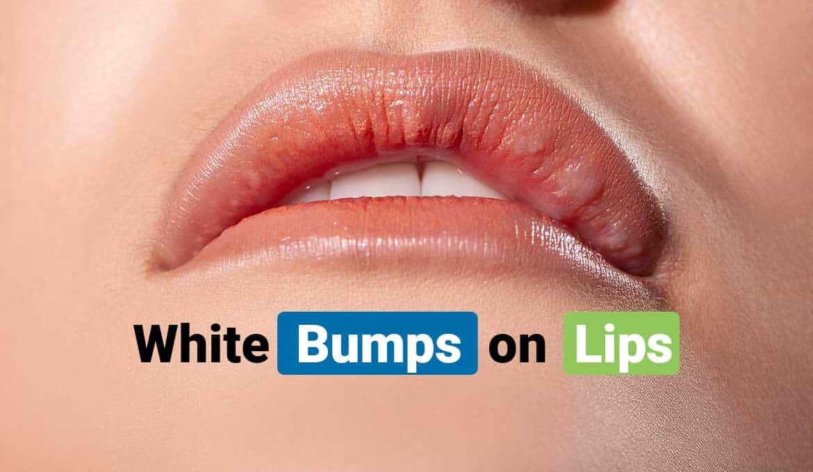 How To Get Rid Of Bumps On Lips - vrogue.co