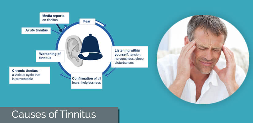 Causes of tinnitus