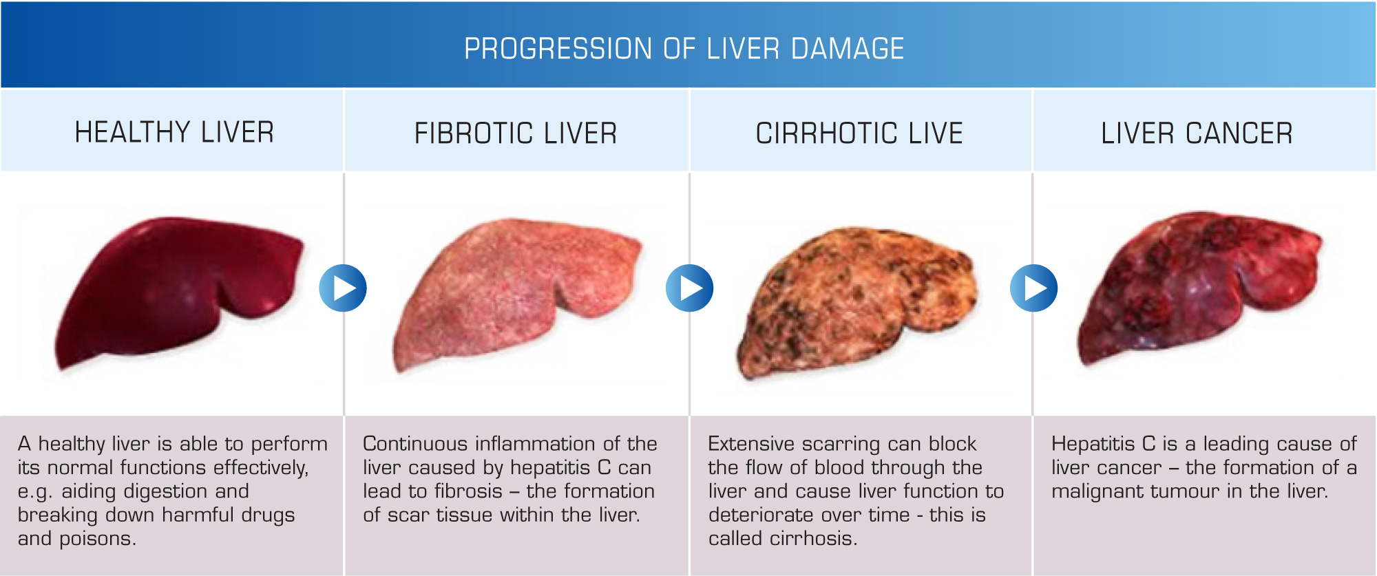 Diagnostic and Treatment Services | Northern Ireland Hepatitis B & C ...