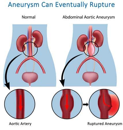 What Is Venous & Arterial Disease