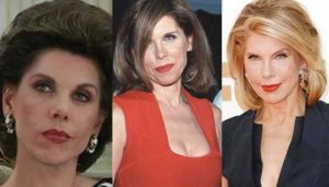 christine baranski plastic surgery