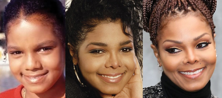 janet jackson plastic surgery