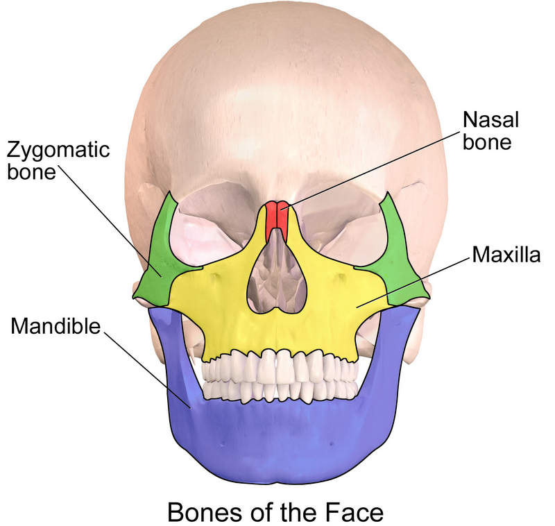 Maxillary Fracture