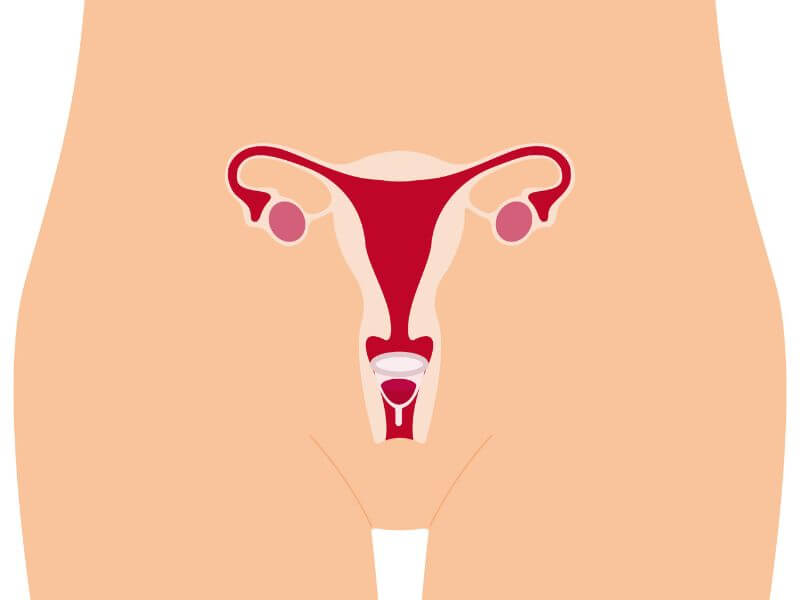   menstrual cup