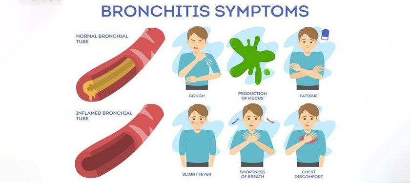 Respiratory Diseases | Krishna Homeopathy Clinic