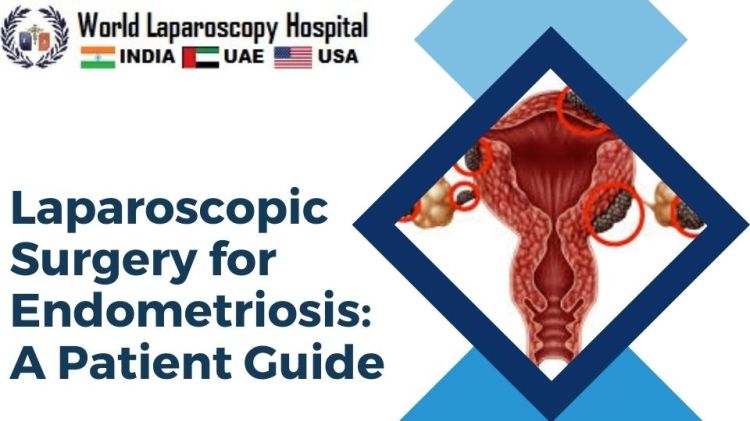 Laparoscopic Surgery for Endometriosis: A Patient Guide