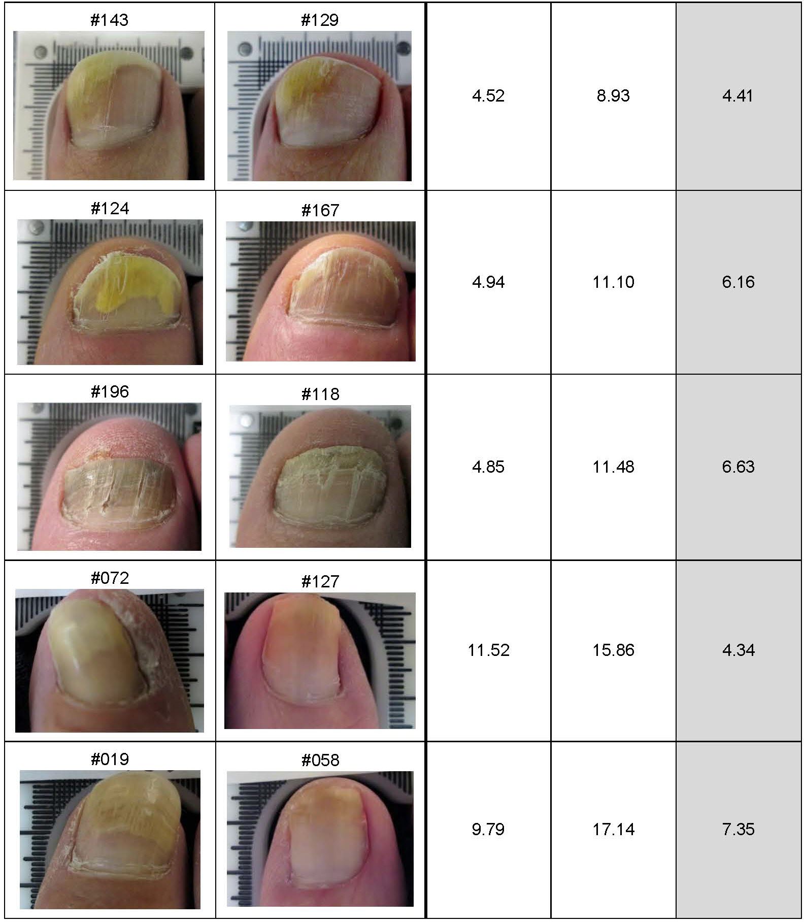 Lunula Clinical Results Summary for Press Release_Page_4