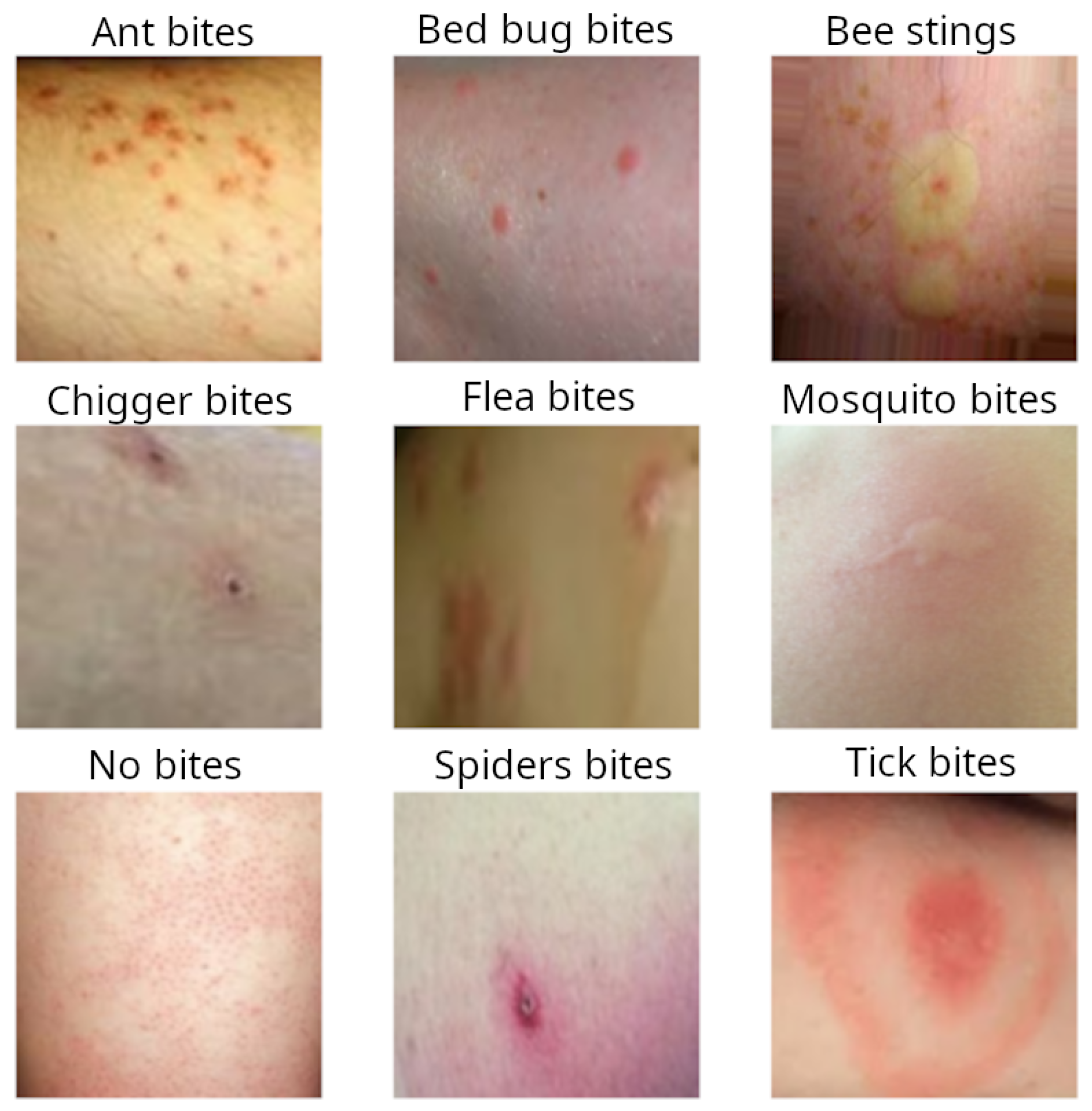 Tick bite identification - serydesigners