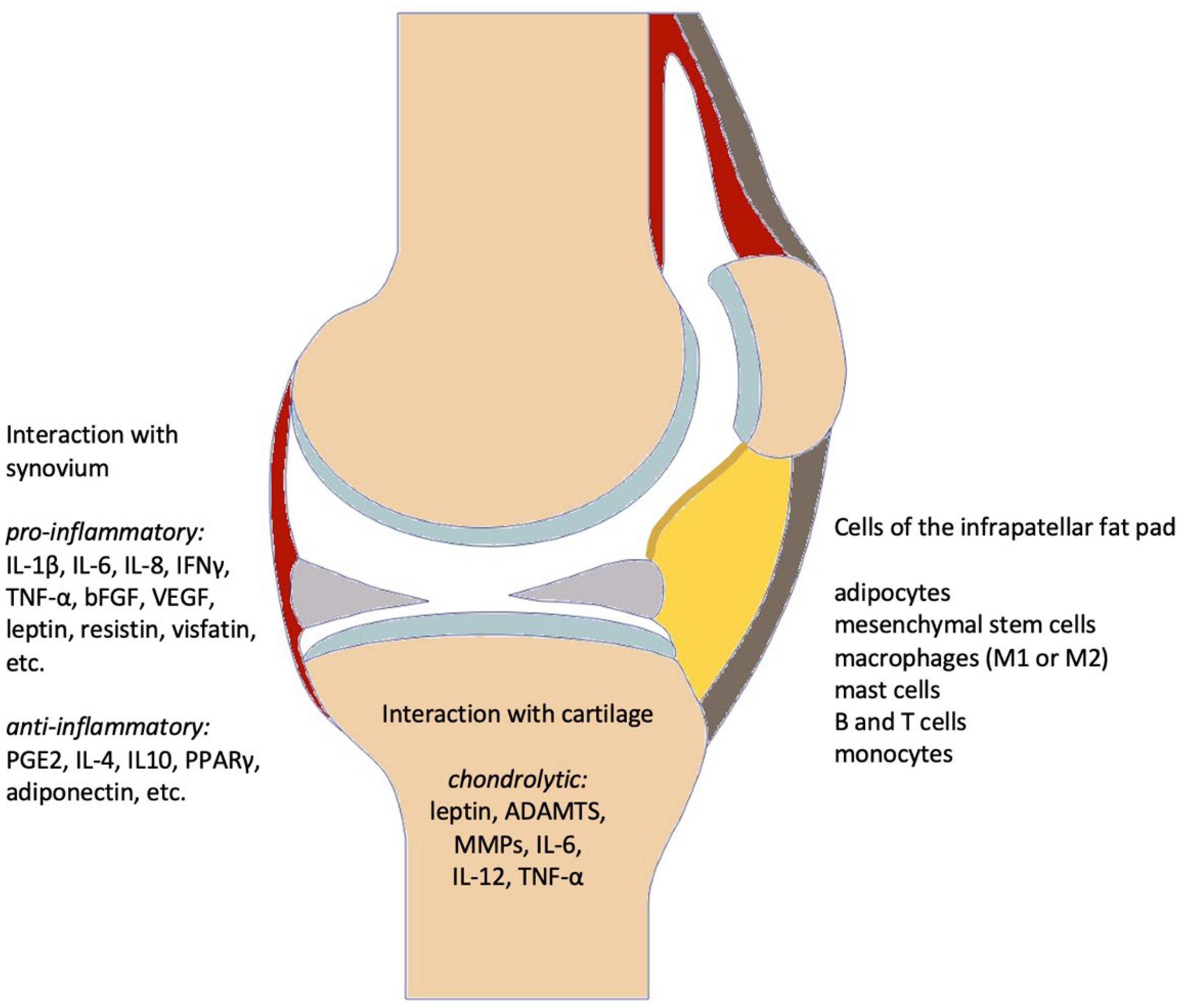 fault bag seamă Banal anterior fat pad impingement medial plicae ...