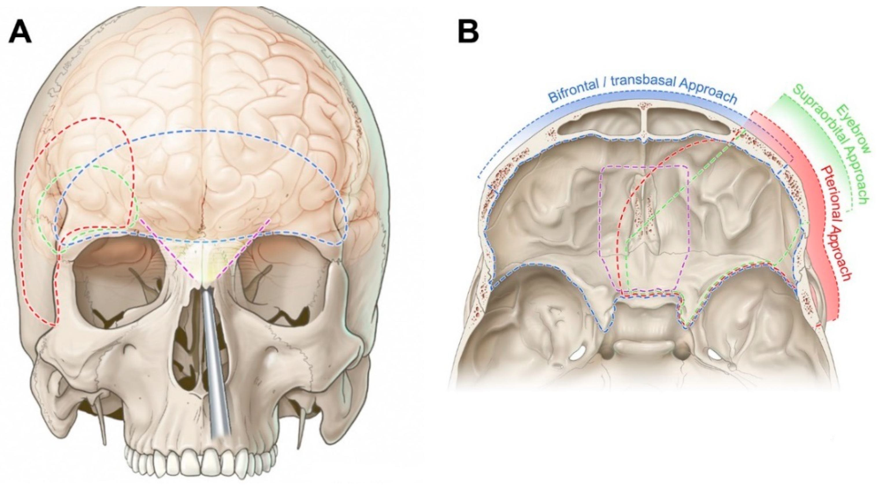 Cancers | Free Full-Text | Surgical Anatomy and Approaches of the ...