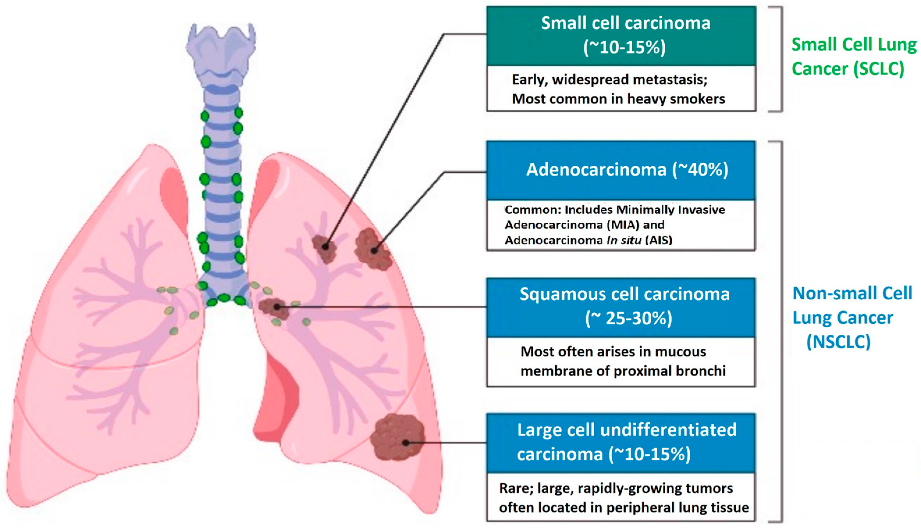 Non Small Cell Adenocarcinoma