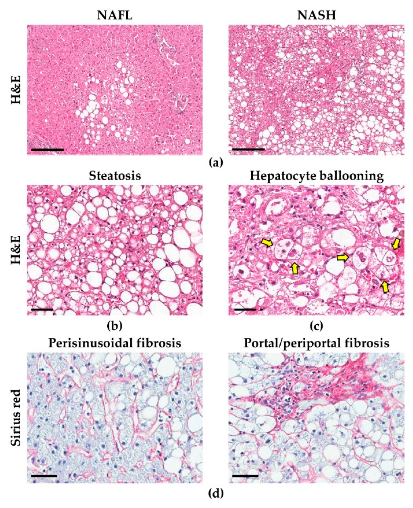 Liver Histology Hepatocytes