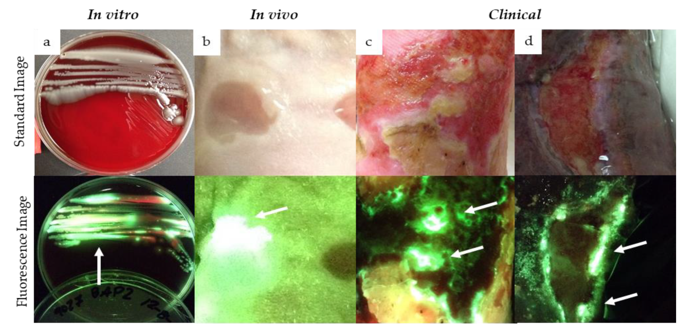 Pseudomonas Aeruginosa Wound