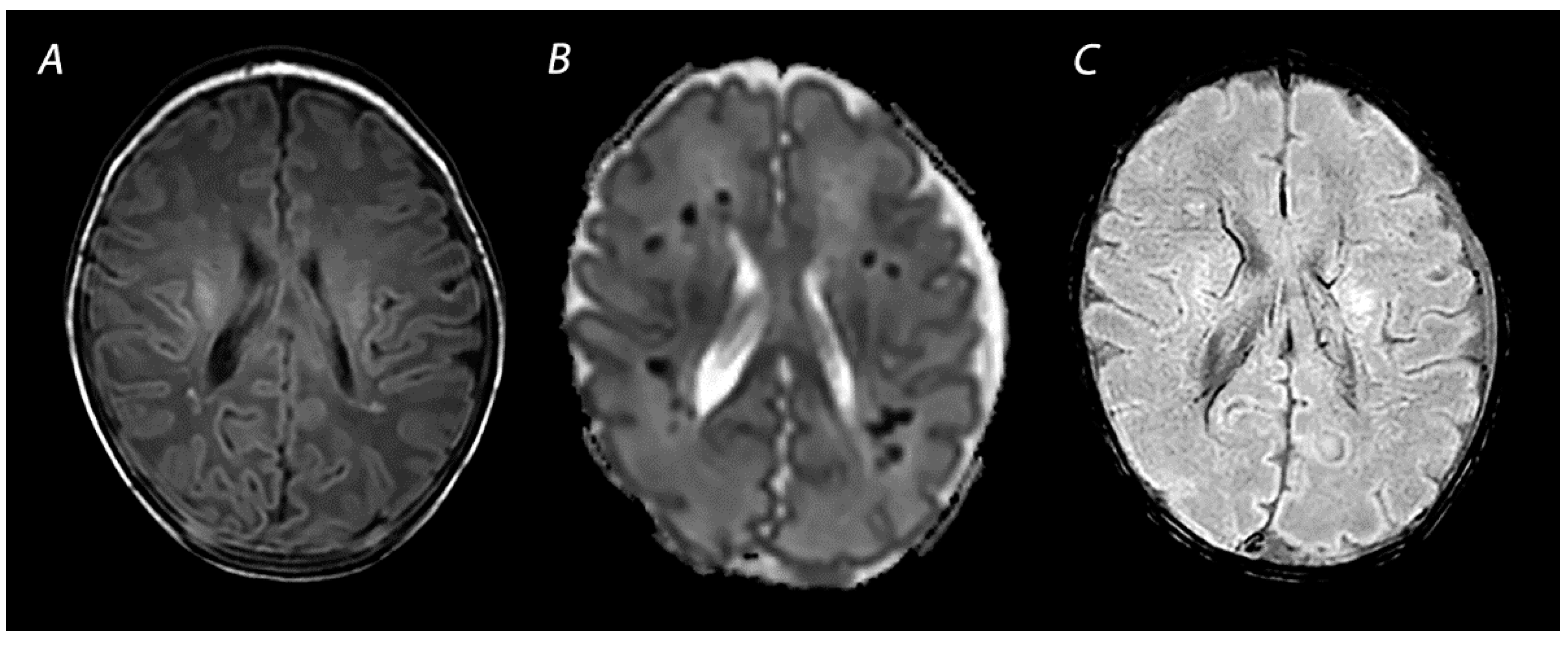 Diagnostics | Free Full-Text | Magnetic Resonance Imaging in (Near ...