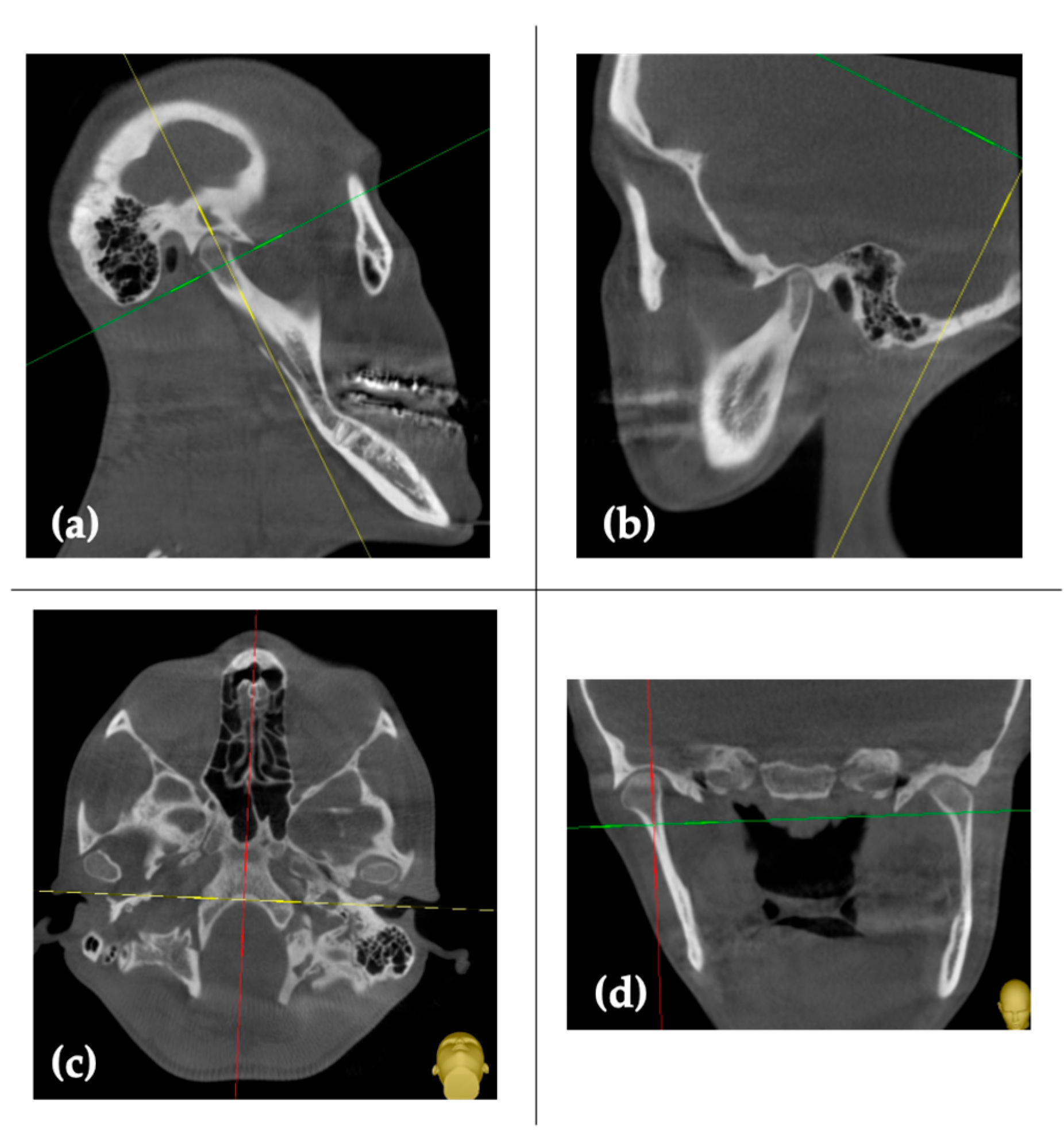 Healthcare | Free Full-Text | The Use of 3D Technology in the ...