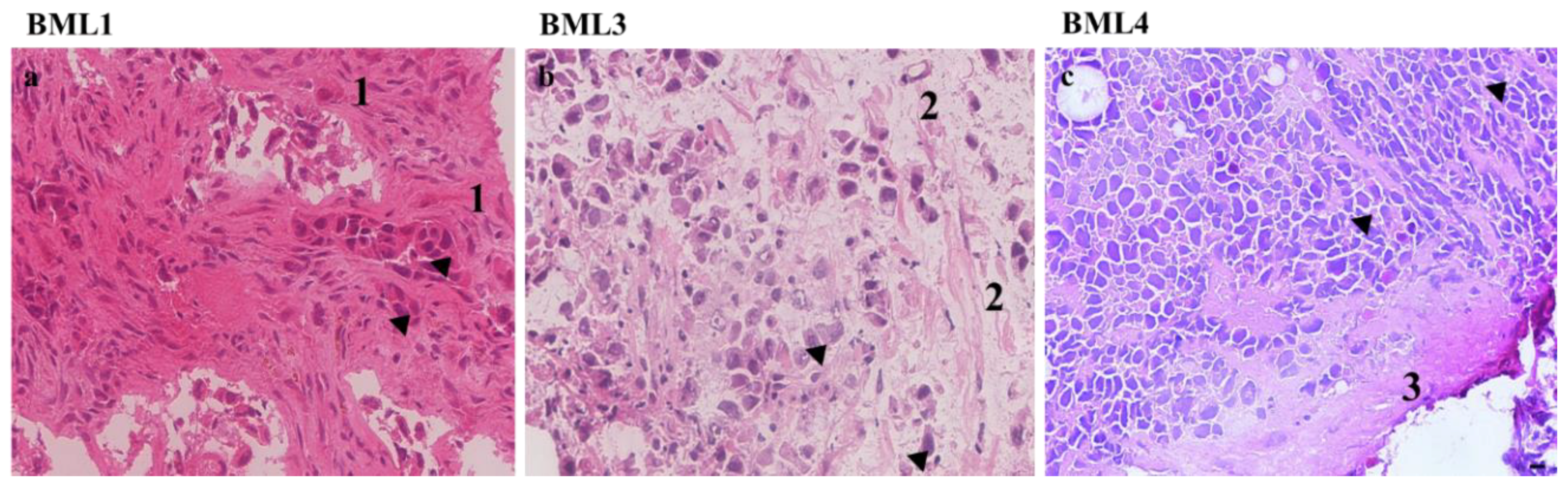 Small Cell Lung Cancer Histology