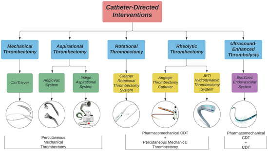 Life | Free Full-Text | Catheter-Directed Interventions for the ...