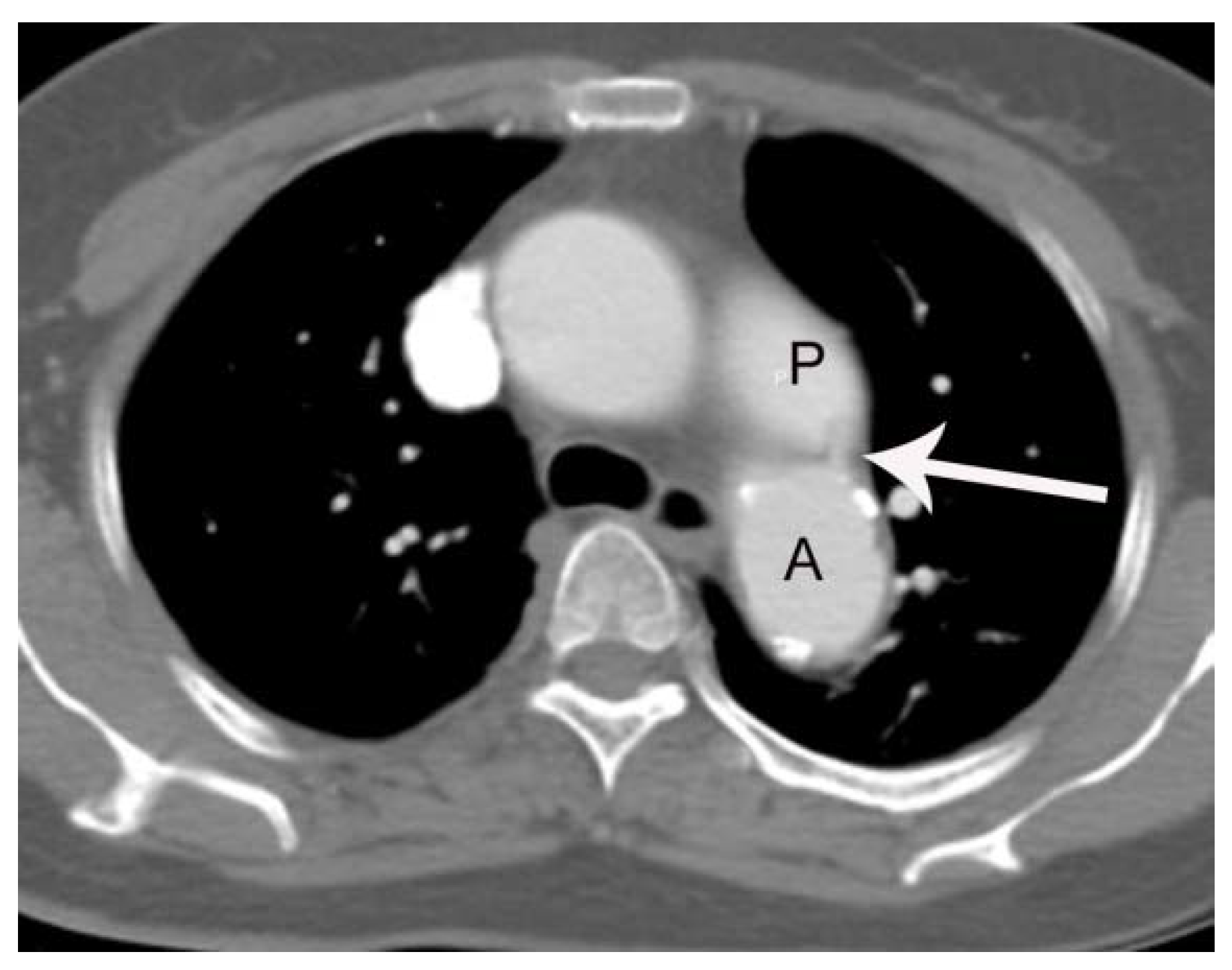 Tomography | Free Full-Text | High Rate of False Negative Diagnosis of ...